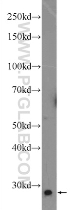 ANKRD49 Antibody in Western Blot (WB)