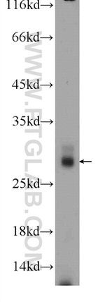 ANKRD49 Antibody in Western Blot (WB)