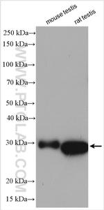 ANKRD49 Antibody in Western Blot (WB)
