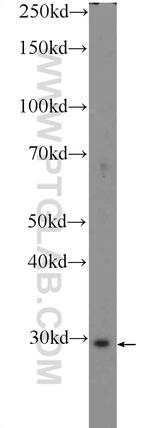 ANKRD49 Antibody in Western Blot (WB)