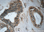 TPPP Antibody in Immunohistochemistry (Paraffin) (IHC (P))