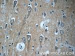 TPPP Antibody in Immunohistochemistry (Paraffin) (IHC (P))