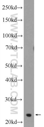 TPPP Antibody in Western Blot (WB)
