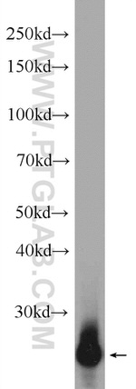 TPPP Antibody in Western Blot (WB)