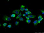 CAPZB Antibody in Immunocytochemistry (ICC/IF)