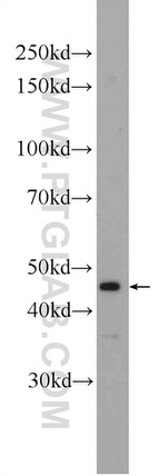 HOXA2 Antibody in Western Blot (WB)