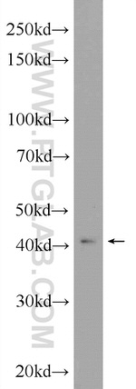 HOXA2 Antibody in Western Blot (WB)