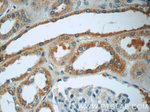LPP Antibody in Immunohistochemistry (Paraffin) (IHC (P))