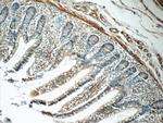 LPP Antibody in Immunohistochemistry (Paraffin) (IHC (P))