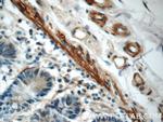 LPP Antibody in Immunohistochemistry (Paraffin) (IHC (P))