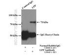 LPP Antibody in Immunoprecipitation (IP)