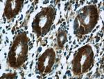 CAPNS1 Antibody in Immunohistochemistry (Paraffin) (IHC (P))