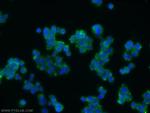 ARRDC3 Antibody in Immunocytochemistry (ICC/IF)