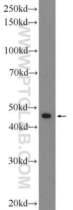 ARRDC3 Antibody in Western Blot (WB)