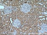RNF135 Antibody in Immunohistochemistry (Paraffin) (IHC (P))
