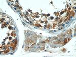 KLHL15 Antibody in Immunohistochemistry (Paraffin) (IHC (P))