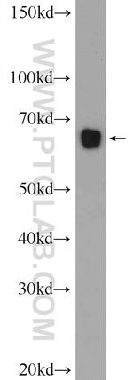 KLHL15 Antibody in Western Blot (WB)