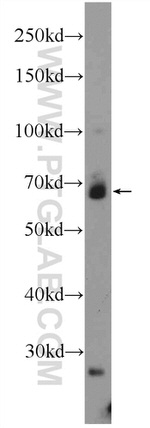 KLHL15 Antibody in Western Blot (WB)