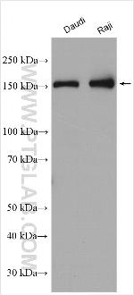 OTUD4 Antibody in Western Blot (WB)