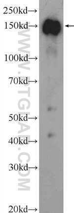 OTUD4 Antibody in Western Blot (WB)