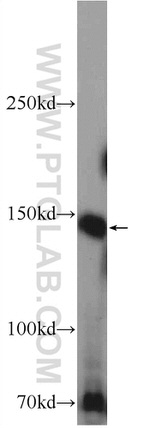 OTUD4 Antibody in Western Blot (WB)