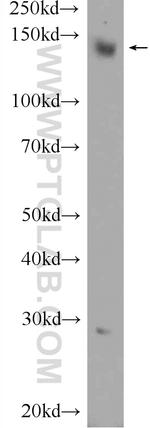 OTUD4 Antibody in Western Blot (WB)