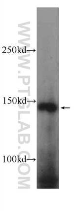 OTUD4 Antibody in Western Blot (WB)