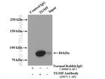 TGM5 Antibody in Immunoprecipitation (IP)