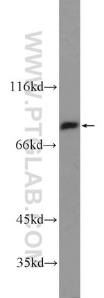 TGM5 Antibody in Western Blot (WB)