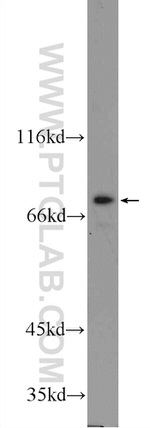 TGM5 Antibody in Western Blot (WB)
