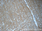 DNAH14 Antibody in Immunohistochemistry (Paraffin) (IHC (P))