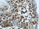 DNAH14 Antibody in Immunohistochemistry (Paraffin) (IHC (P))