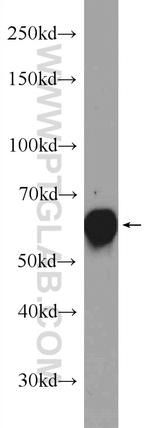 GDPD2 Antibody in Western Blot (WB)
