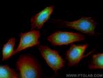 TMEM134 Antibody in Immunocytochemistry (ICC/IF)