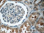 GNE Antibody in Immunohistochemistry (Paraffin) (IHC (P))