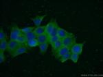 PGP Antibody in Immunocytochemistry (ICC/IF)