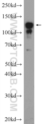 CLIP-115/CYLN2 Antibody in Western Blot (WB)