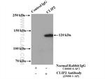 CLIP-115/CYLN2 Antibody in Immunoprecipitation (IP)
