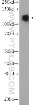 CLIP-115/CYLN2 Antibody in Western Blot (WB)