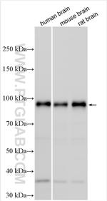 PPM1E Antibody in Western Blot (WB)