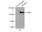 PCDH9 Antibody in Immunoprecipitation (IP)