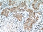 TMEM87A Antibody in Immunohistochemistry (Paraffin) (IHC (P))