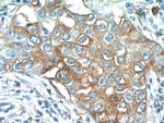 TMEM87A Antibody in Immunohistochemistry (Paraffin) (IHC (P))