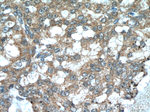 TMEM87A Antibody in Immunohistochemistry (Paraffin) (IHC (P))