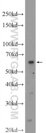 TMEM87A Antibody in Western Blot (WB)