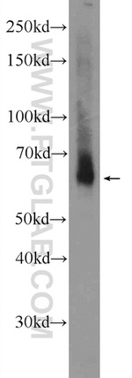 TMEM87A Antibody in Western Blot (WB)