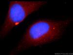 ZNF277 Antibody in Immunocytochemistry (ICC/IF)