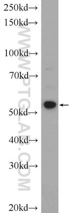 ZNF277 Antibody in Western Blot (WB)