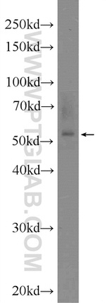 ZNF277 Antibody in Western Blot (WB)