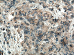 WFDC12 Antibody in Immunohistochemistry (Paraffin) (IHC (P))
